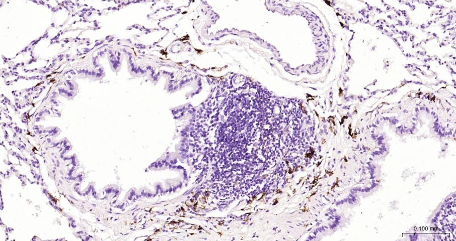 CD163 Rabbit pAb(bs-2527R)-50u