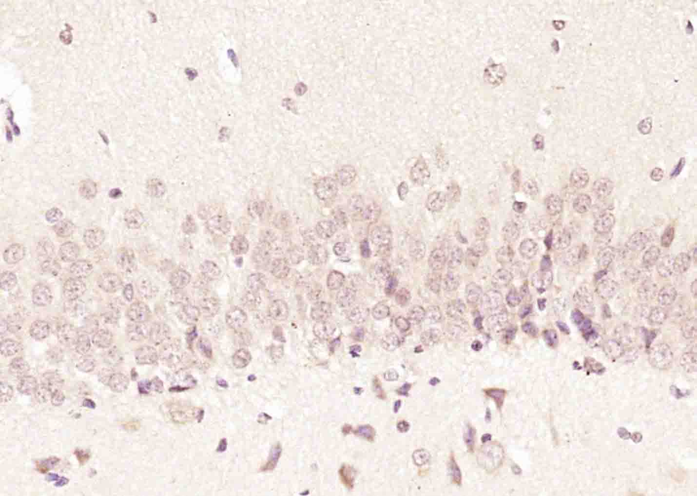 FAM46C Rabbit pAb(bs-8198R)-50