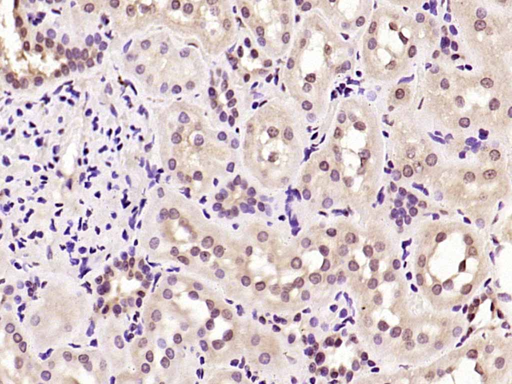 Cyclin D1 Rabbit pAb(bs-20596R