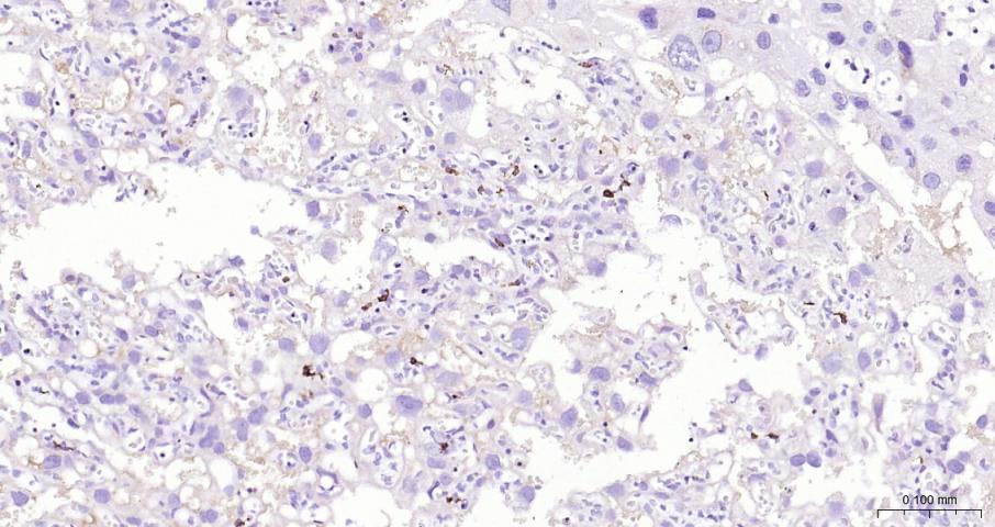 CD163 Rabbit pAb(bs-2527R)-50u