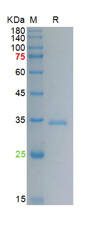 Recombinant human IGFBP1 prote
