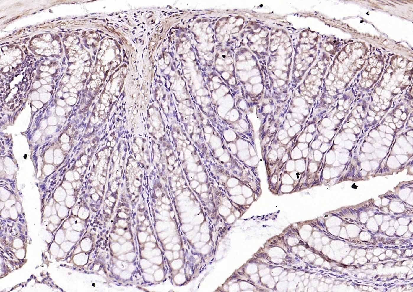 CREM Rabbit pAb(bs-5135R)-50ul