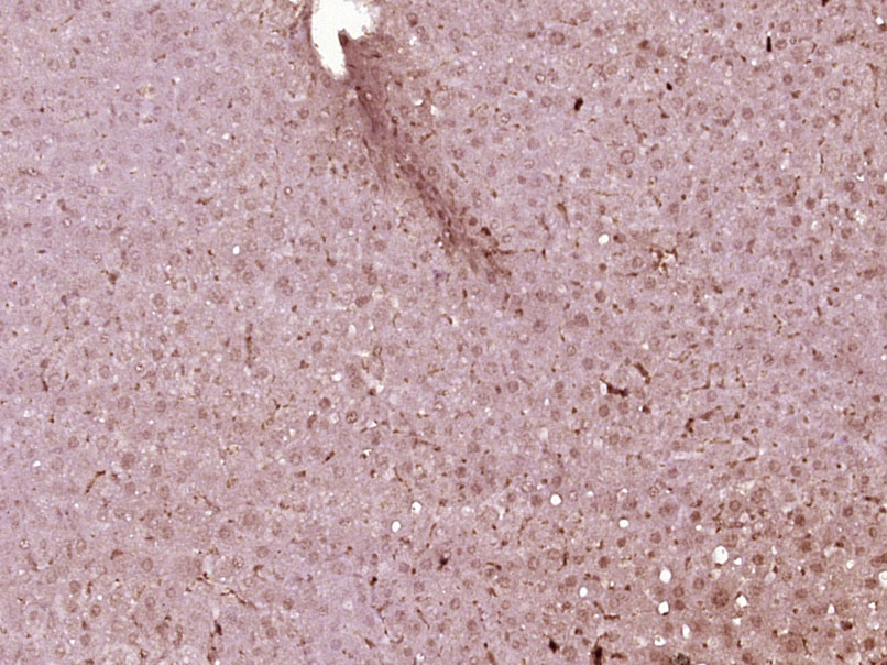 HNF1A Rabbit pAb(bs-1405R)-50u