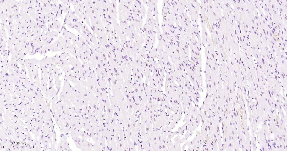 phospho-STAT3 (Tyr705) Mouse m