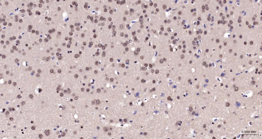 Histone H3(di methyl K27) Mous