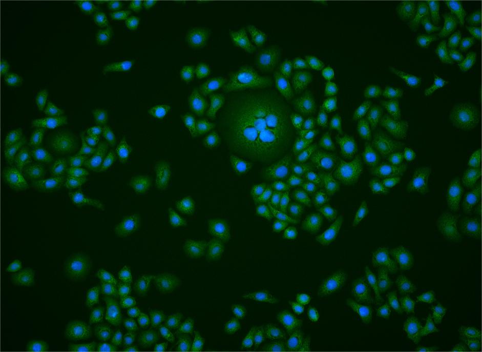 ABCF1 Rabbit pAb(bs-1960R)-50u