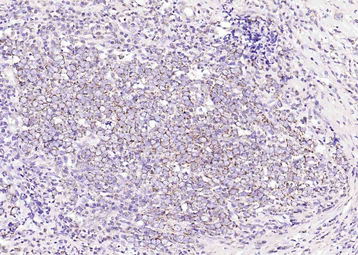 DIO2 Rabbit pAb(bs-3673R)-50ul