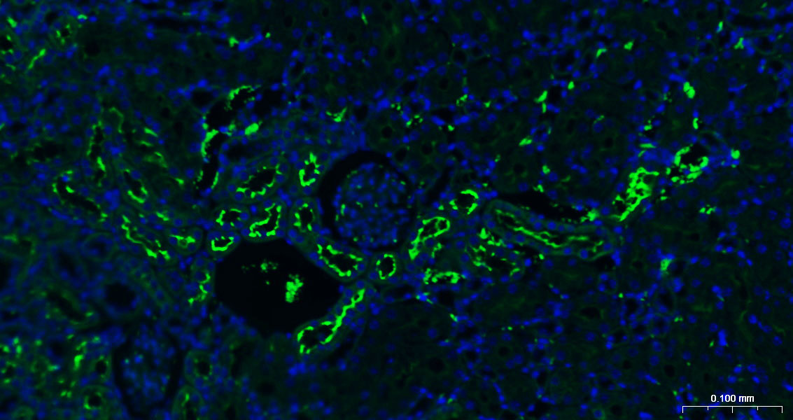 ACE2 Recombinant Rabbit mAb(bs
