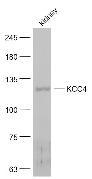 KCC4 Rabbit pAb(bs-12170R)-50u
