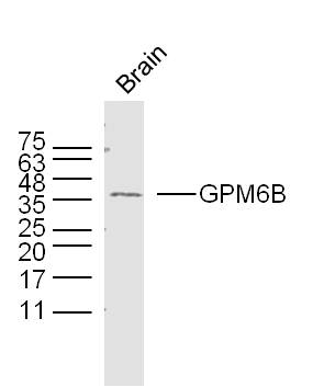 GPM6B Rabbit pAb(bs-11847R)-50