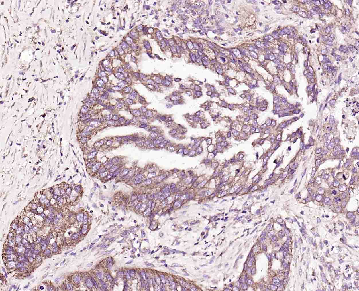 CD48 Rabbit pAb(bs-2497R)-50ul