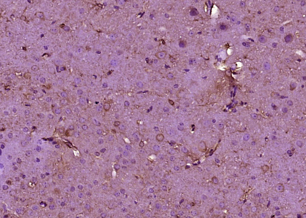 PAN3 Rabbit pAb(bs-21013R)-50u