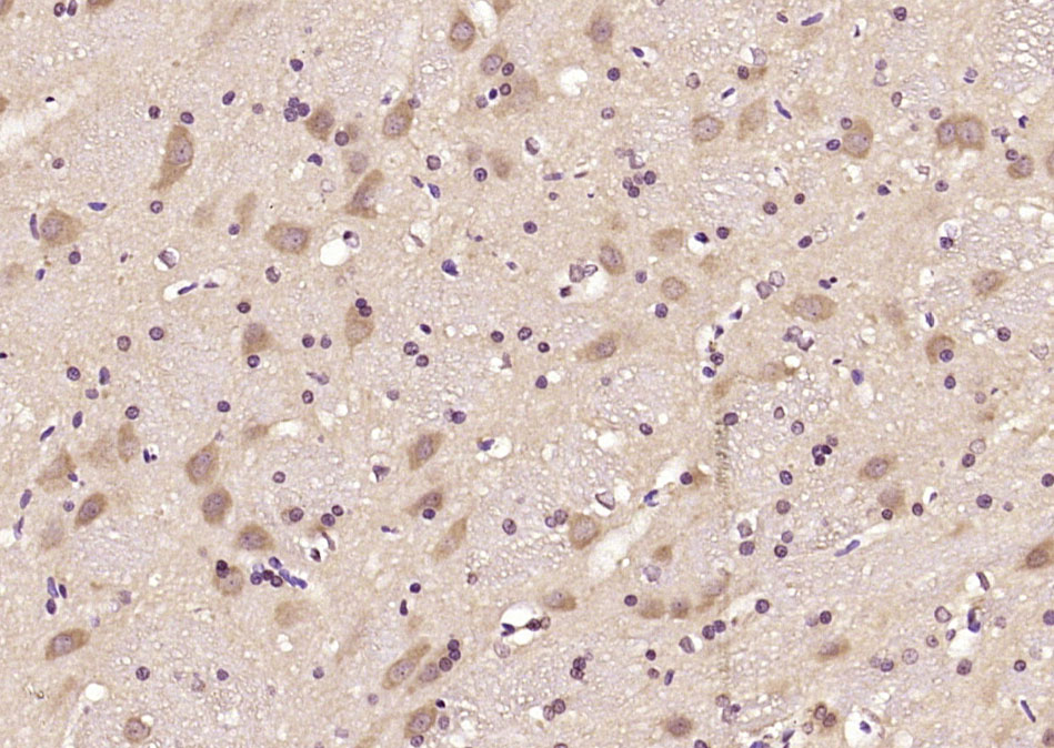 Artemin Rabbit pAb(bs-22203R)-