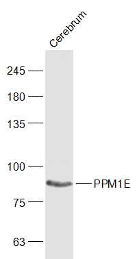 PPM1E Rabbit pAb(bs-21063R)-50