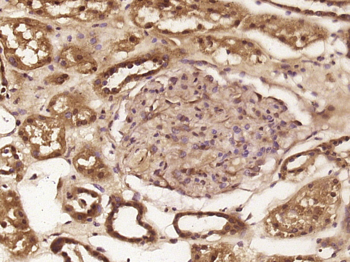 phospho-c-Abl (Ser569) Rabbit 