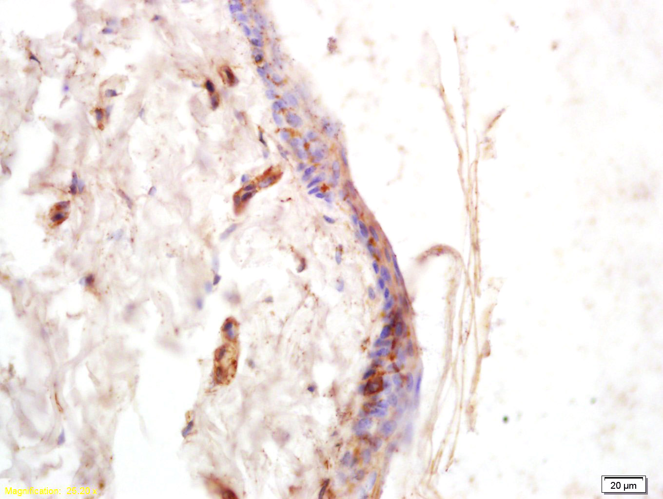 COL6A5 Rabbit pAb(bs-11047R)-5