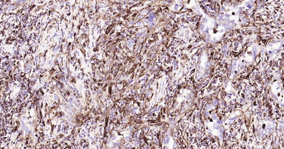 Vimentin Mouse mAb(bsm-33170M)