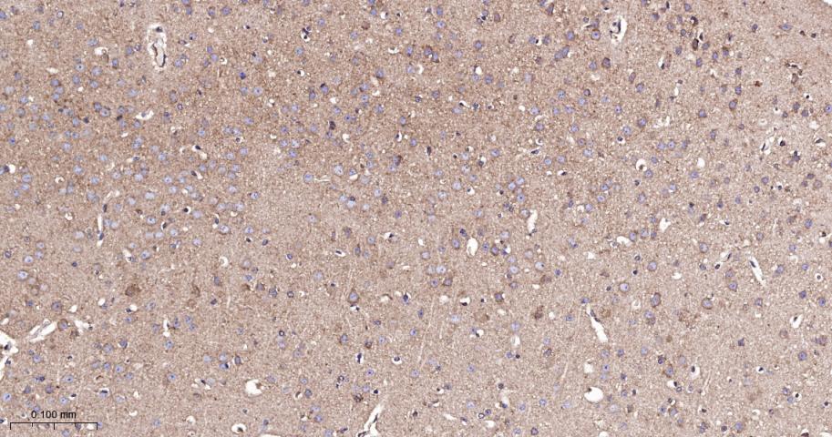 EEF1A1 Recombinant Rabbit mAb(