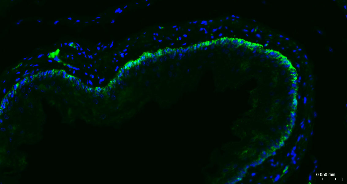 Cytokeratin 14 Recombinant Rab