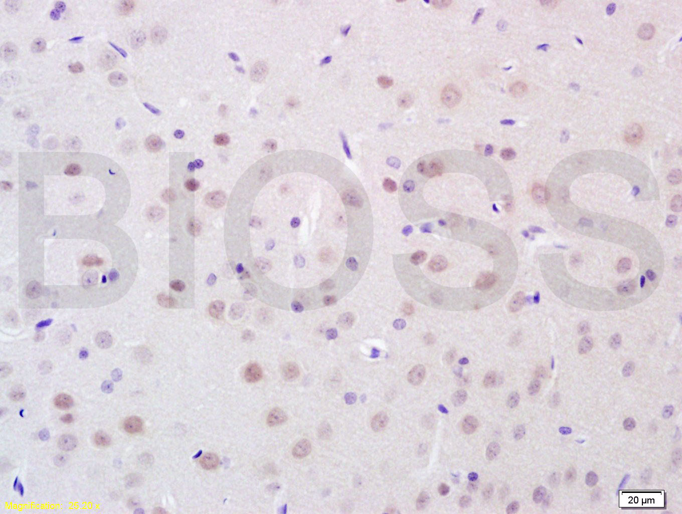 BRN3A Rabbit pAb(bs-3669R)-50u