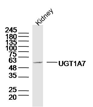 UGT1A7 Rabbit pAb(bs-20068R)-5