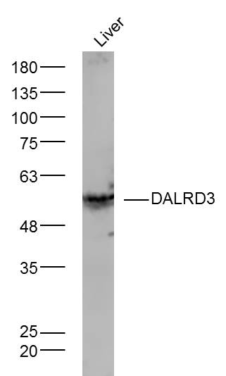 DALRD3 Rabbit pAb(bs-14192R)-5