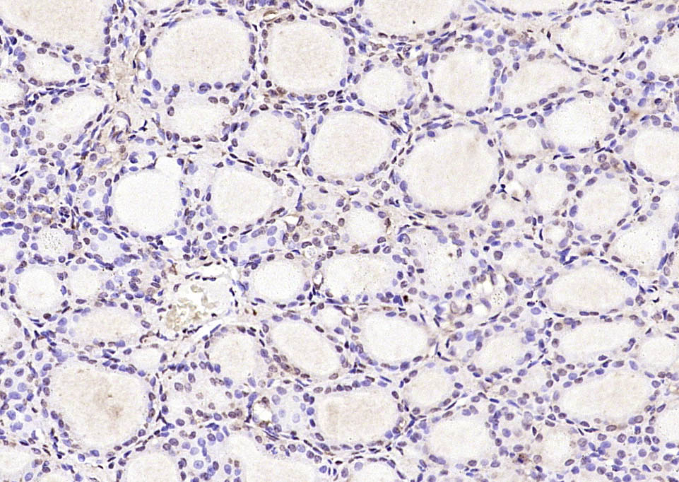 UBE2V1 Rabbit pAb(bs-7882R)-50