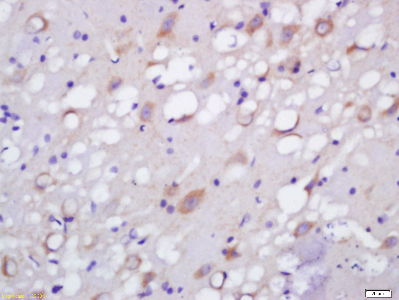 NETO1 Rabbit pAb(bs-8588R)-50u