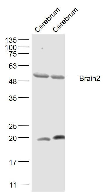 Brain2 Rabbit pAb(bs-10077R)-5