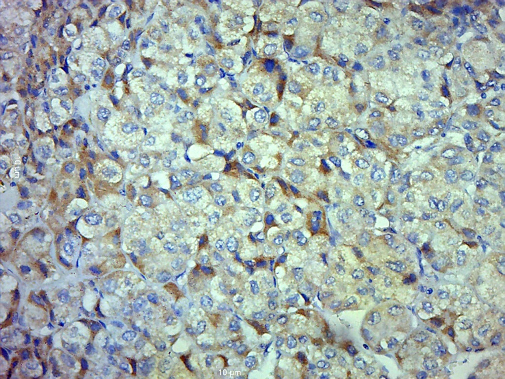 Cystatin A Rabbit pAb(bs-5114R