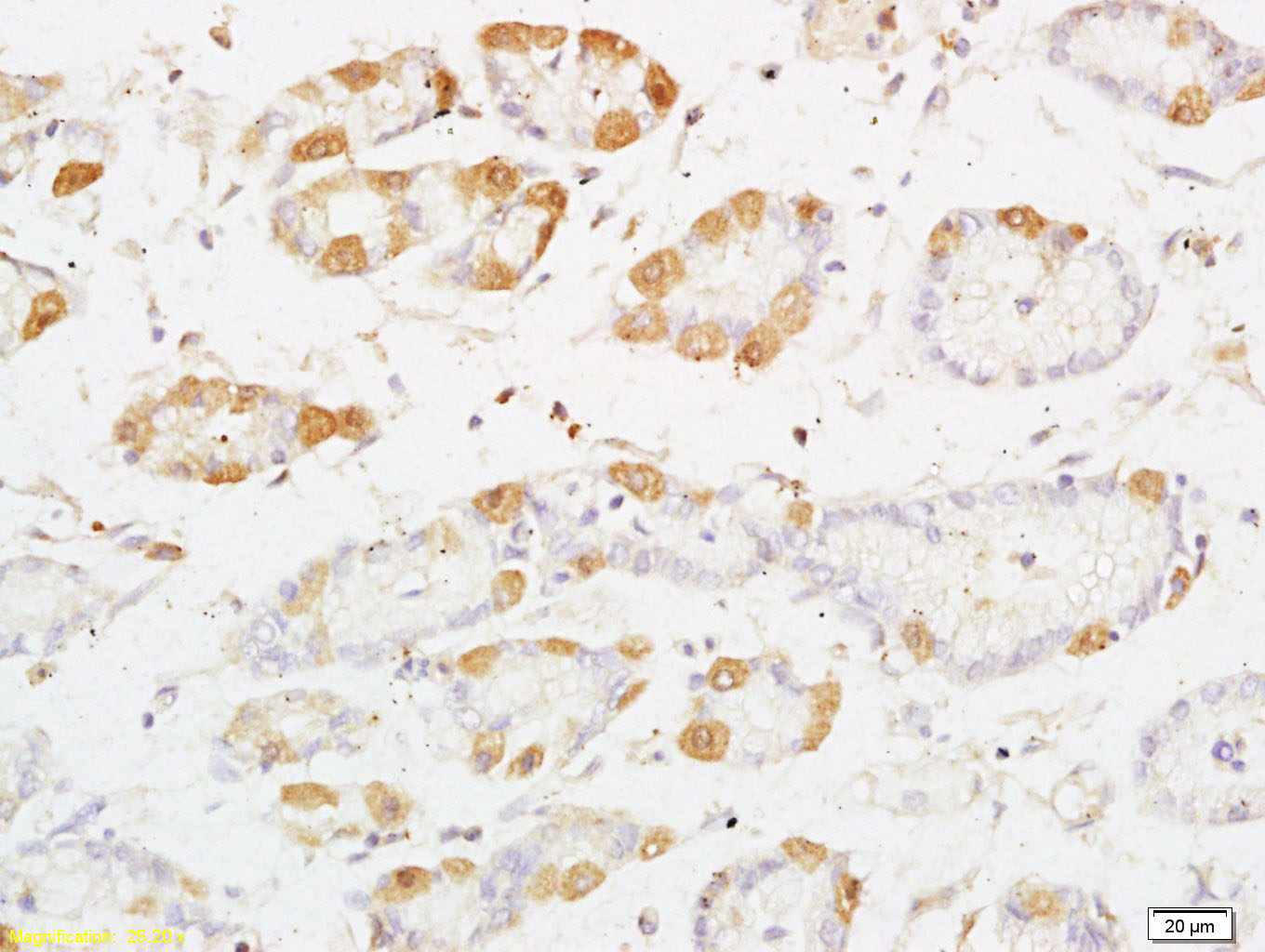 PRKD3 Rabbit pAb(bs-4157R)-50u