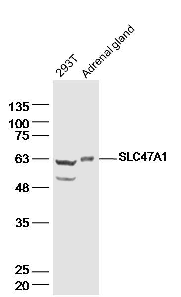 SLC47A1 Rabbit pAb(bs-9284R)-5