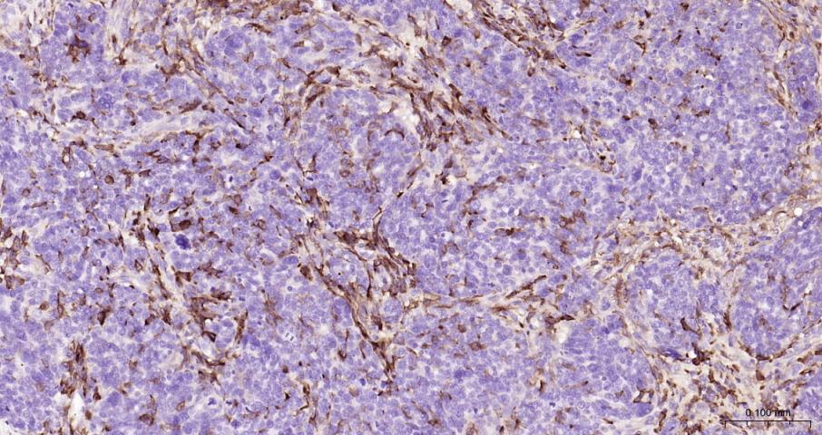 CD163 Rabbit pAb(bs-2527R)-50u