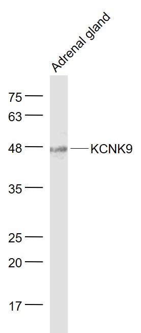 KCNK9 Rabbit pAb(bs-5933R)-50u
