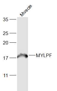 MYLPF Rabbit pAb(bs-5159R)-50u