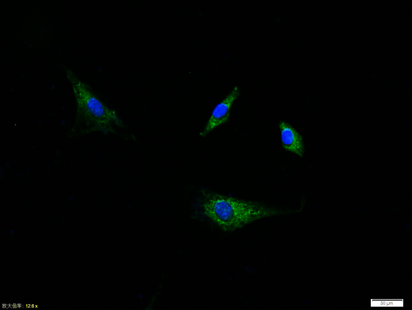 phospho-PDGFRA (Tyr754) Rabbit