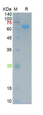 Recombinant human Transferrin 