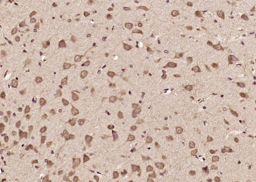 DENND5A Rabbit pAb(bs-14274R)-