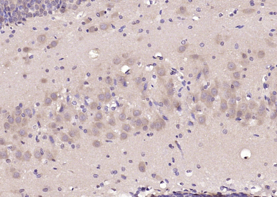 GABRA1/GABA A Receptor alpha 1
