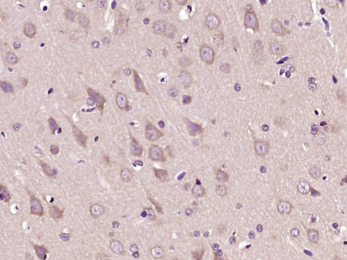 KIAA1434 Rabbit pAb(bs-17006R)