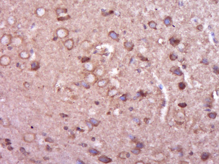 EXOSC6 Rabbit pAb(bs-14669R)-5