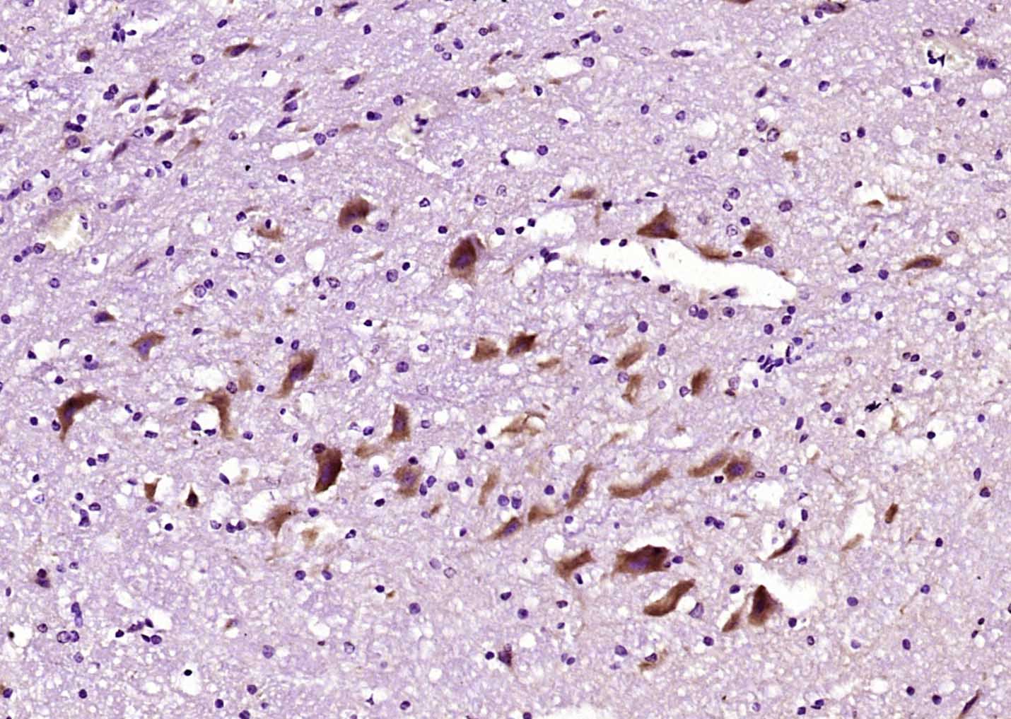 ITPR3 Rabbit pAb(bs-6471R)-50u