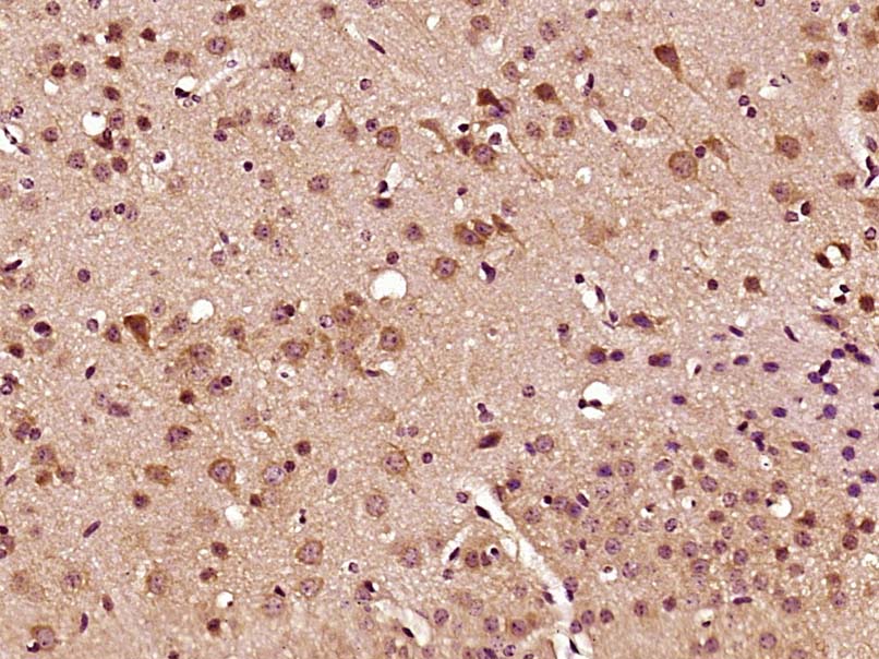 C2orf63 Rabbit pAb(bs-16119R)-