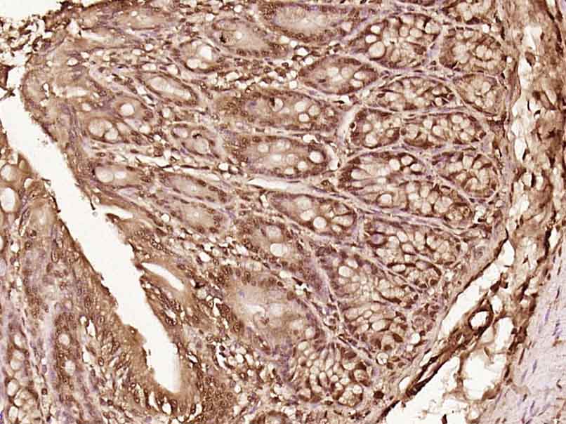 LTV1/C6orf93 Rabbit pAb(bs-184