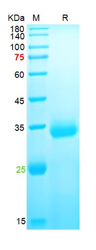 Recombinant SARS-Cov-2 Spike R