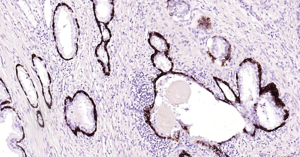 Cytokeratin 14 Recombinant Rab