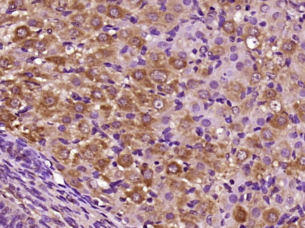 CILP Rabbit pAb(bs-13954R)-50u