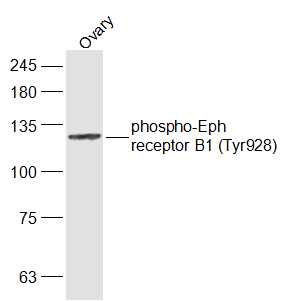 phospho-Eph receptor B1 (Tyr92