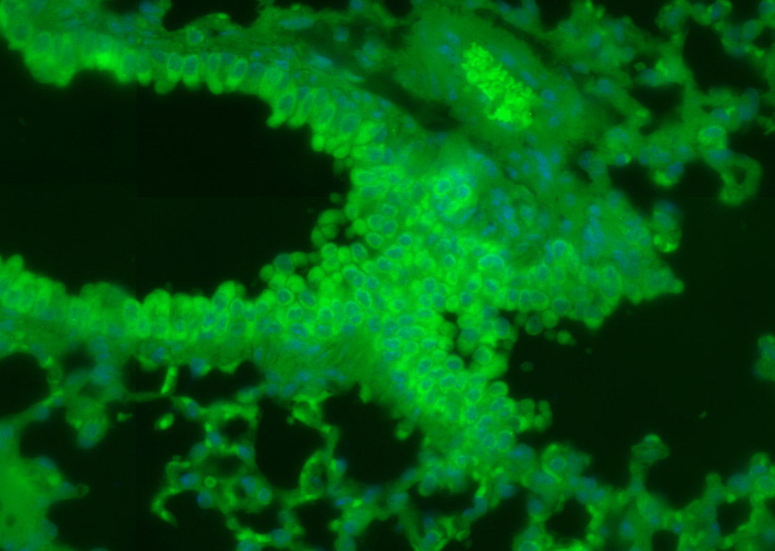 Phospholipase C beta 2 Rabbit 