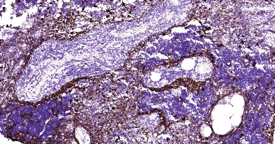 Cytokeratin 14 Recombinant Rab